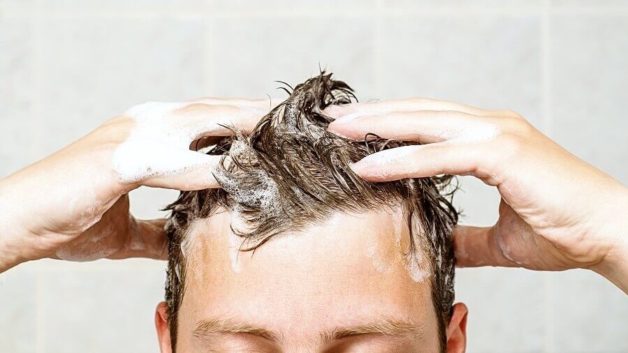 哪一種洗髮露能去除油性頭皮屑？