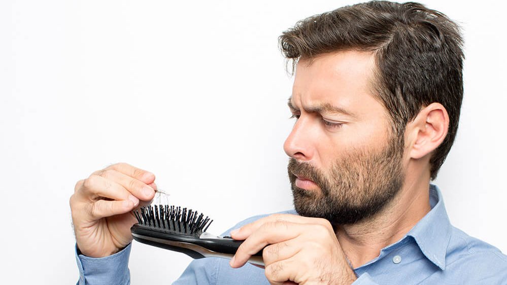 Erblich Bedingter Haarausfall Das Muss Mann Wissen