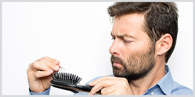 Erblich bedingter Haarausfall beim Mann